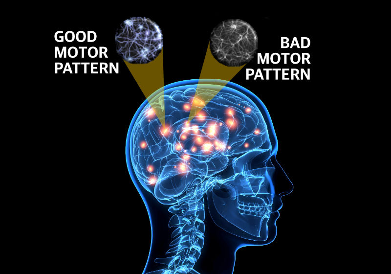 motor-access-brain-golf